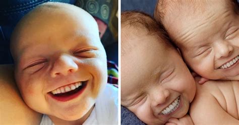 Disturbing Photos Of Babies With Grown Up Teethyouve Been Warned