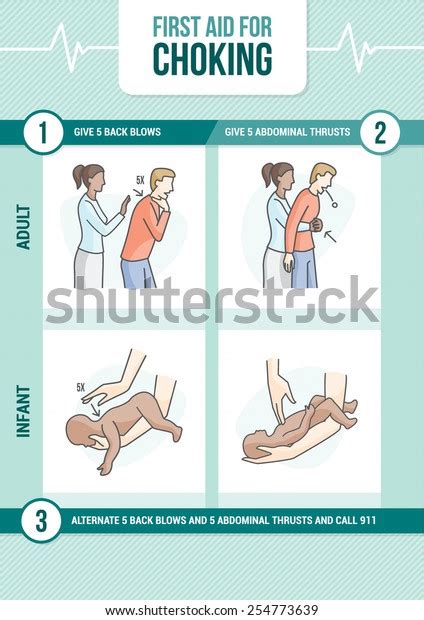 First Aid Procedure Choking Heimlich Maneuver Stock Vector Royalty Free 254773639 Shutterstock