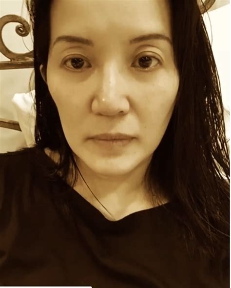 Kris Aquino Chronic Disease Revealed Actress Thankful For Prayers