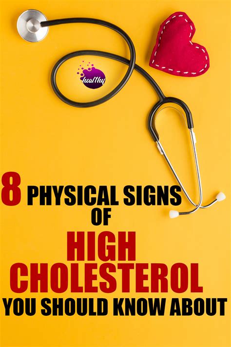 Symptoms Of High Cholesterol In 2020 High Cholesterol Symptoms High