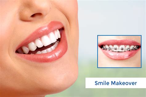 Cosmetic Dentistry Allows You A Complete New Way To Smile Aesthetix Dental Care Surat