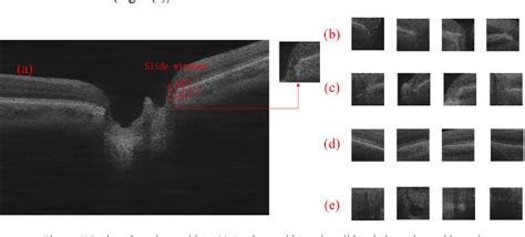 Figure 4 From Automated Segmentation Of Optic Disc In Sd Oct Images And