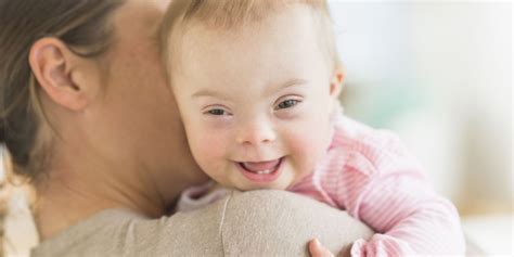 Como Saber Se Um Bebê Tem Síndrome De Down Exames Pré Natal Blog