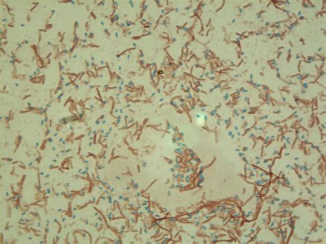 Staphylococcus Epidermidis Endospore Stain