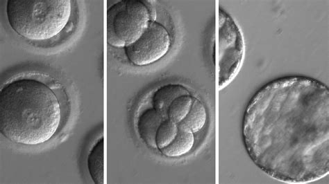 Dna Surgery On Embryos Removes Disease Bbc News