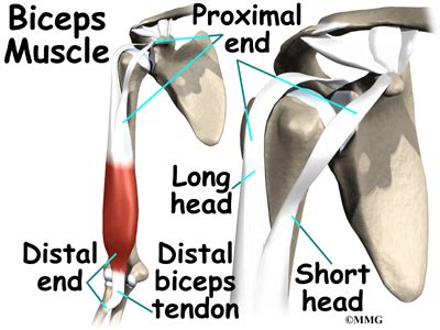 Begin using curl variations that place the shoulder in a passively flexed posture, with the goal to eventually perform the movement at greater angles of extension. Biceps Tendonitis | eOrthopod.com