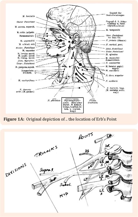 Figure 1 From The Vulcan Nerve Pinch Cultural Iconography Anchors The