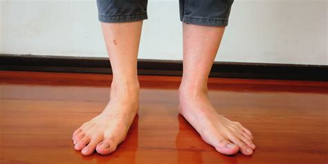 What Is Pronation Understanding Your Feet Kintec Footwear Orthotics