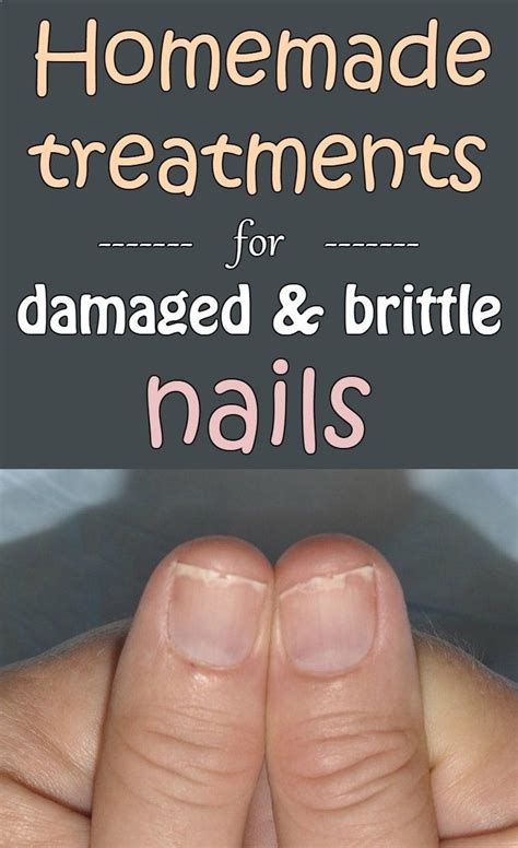 Homemade Treatments For Damaged And Brittle Nails Brittle Nails