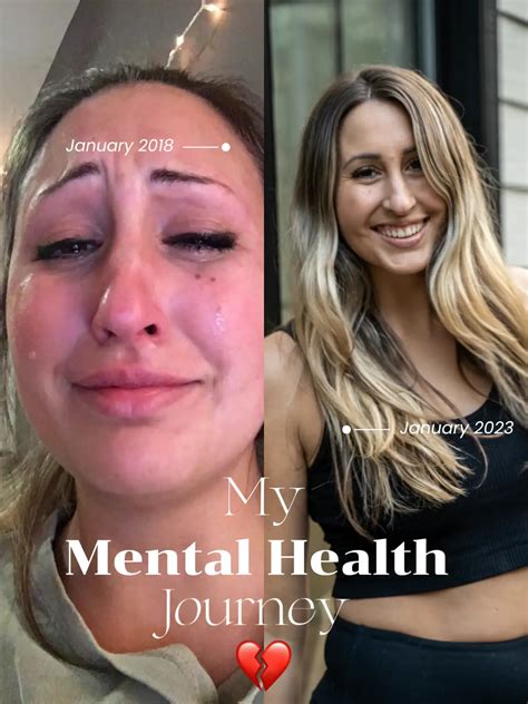 My Very Honest Mental Health Journey Gallery Posted By Meg Lemon8