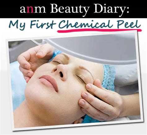 Anm Beauty Diary My First Chemical Peel