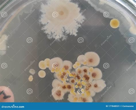 Bacterial And Fungal Colonies On Saboraud Dextrose Agar Medium Stock