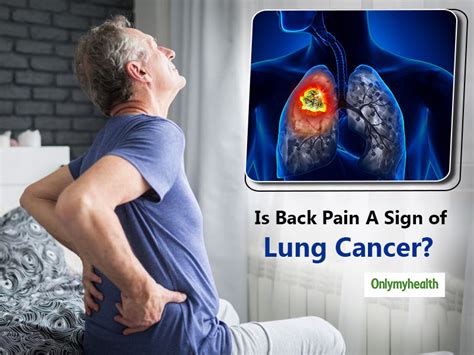 What Is The Correlation Between Back Pain And Lung Cancer Onlymyhealth