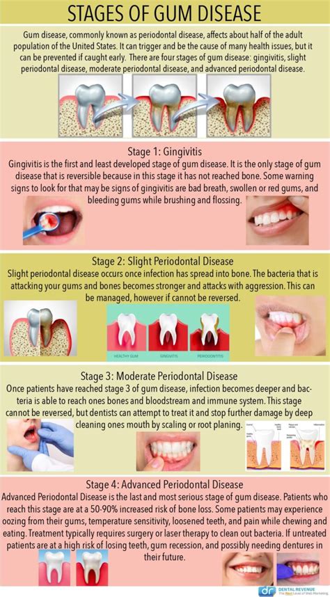 Gum Disease Treatments NewWriting Publishing