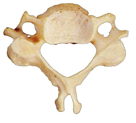 Typical Cervical Vertebrae Anatomy C3 C7 Diagram Quizlet