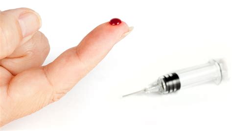 Global Survey Nearly All Surgeons Encounter Needlestick Injury