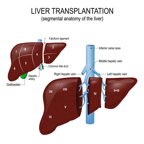 Liver Transplant Diagram