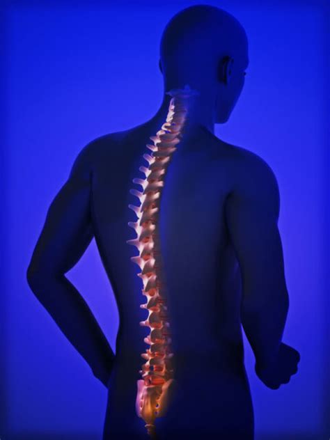 Spondylolisthesis Rules My Life Chiropractic Clinics Of South