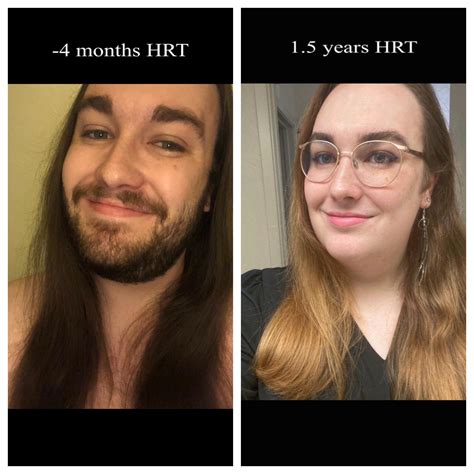 Hormones Are Pure Magic And Trans Is Beautiful Babes