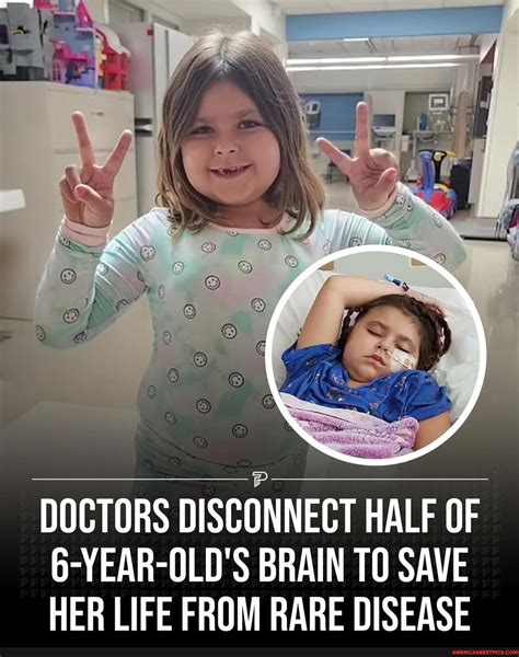 Ss Doctors Disconnect Half Of 6 Year Olds Brain To Save Her Life From