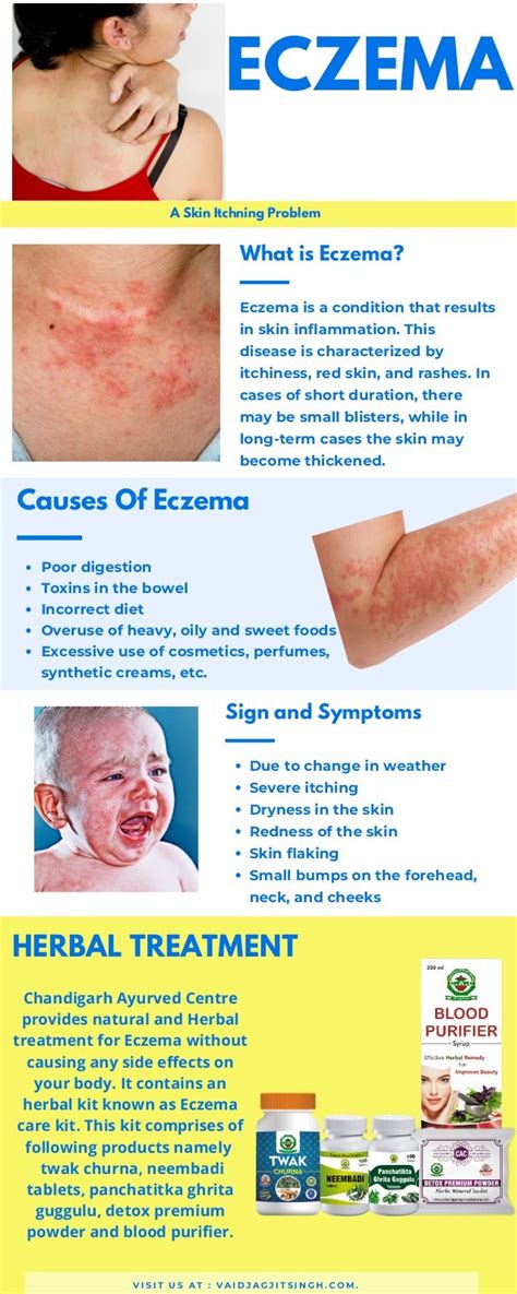 Eczema Causes Symptoms And Treatment