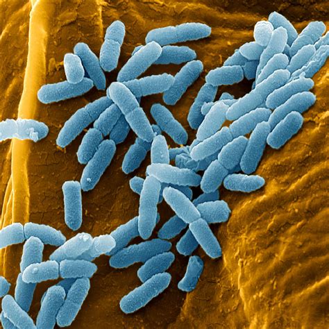 Pseudomonas Aeruginosa Bacteria Sem Photograph By Juergen Berger Pixels
