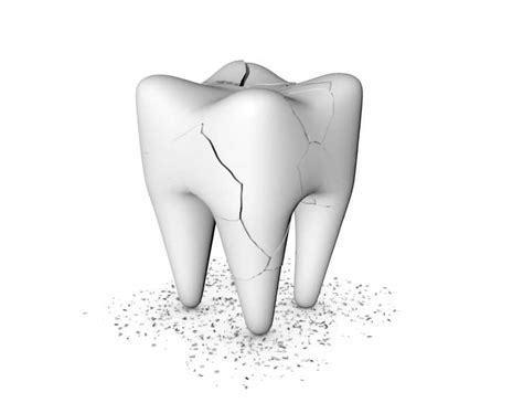 Restoring Your Broken Tooth In Conroe Conroe Tx