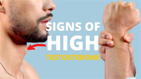 Physical Signs You Have High Testosterone Levels Youtube