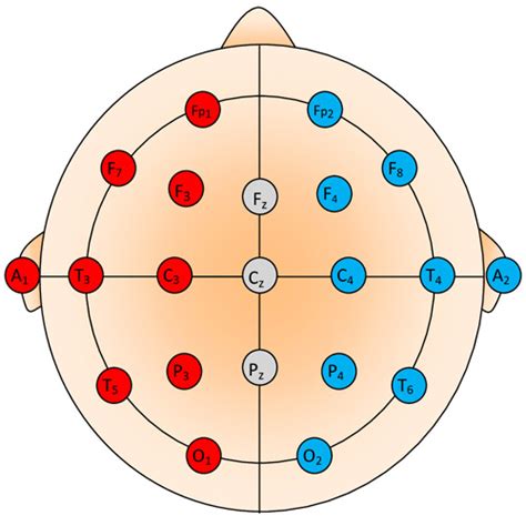 Basic Eeg Lead Placement Diagram