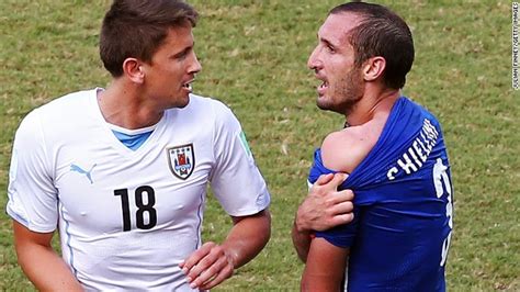 Chiellini Ear World Cup Stunning Moments Luis Suárez Bites Giorgio