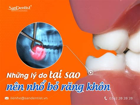 Lưu ý Sau Khi Nhổ Răng Khôn Mà Bạn Cần Phải Biết San Dentist