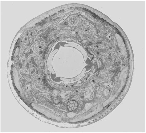 Eukaryotic Cell Under Electron Microscope Micropedia