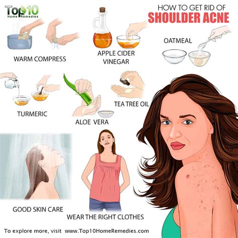 How To Get Rid Of Arm And Shoulder Acne
