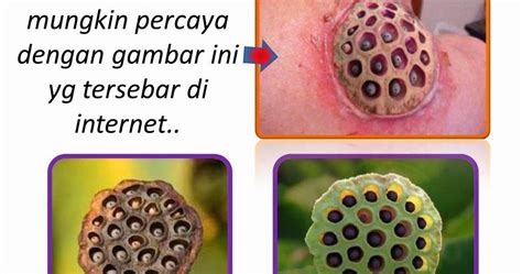 Trypophobia Symptoms Causes And Treatments Rezfoods Resep Masakan Indonesia