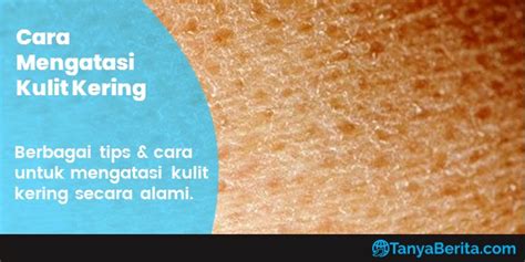 Salah satu cara merawat jaket kulit dengan benar adalah segera keringkan jaket. 10 Cara Mengatasi Kulit Kering dengan Bahan Alami, Ampuh, Cepat dan Mudah Dicoba | Tanya Berita