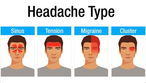 Headache Chart Types By Symptoms Location And Causes 57 Off