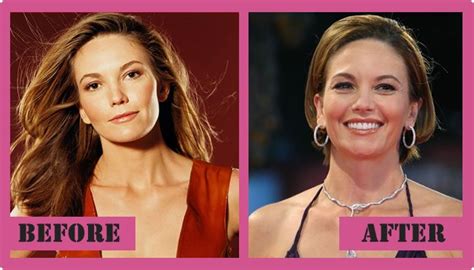 Diane Lane Plastic Surgery Telegraph