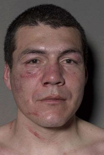 Boxers Before And After A Fight 12 Pics