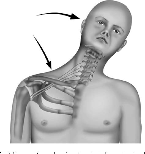 Figure 1 From Surgical Treatment Of Adult Traumatic Brachial Plexus
