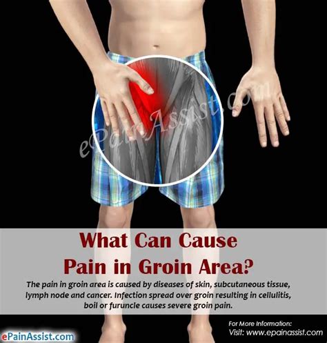 What Does Groin Pain Mean