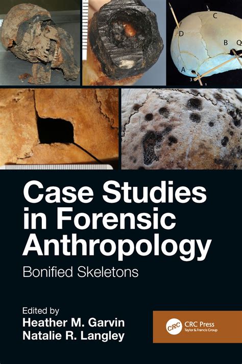 Books On Forensic Anthropology