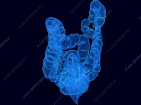 Human Intestines Rotating 3d Ct Scan Stock Video Clip K0075400