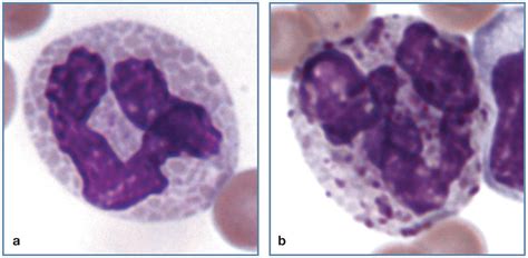 The Feline Blood Film 2 Leukocyte And Platelet Morphology John W