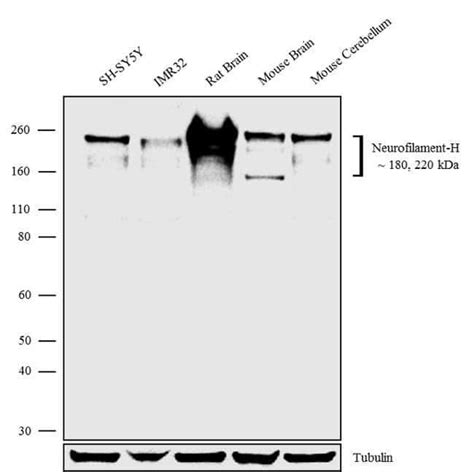 Nf H Recombinant Rabbit Monoclonal Antibody 4h6l2 Invitrogen 100 μg