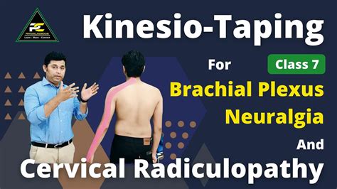 Kinesio Taping For Brachial Plexus Neuralgia Cervical Radiculopathy
