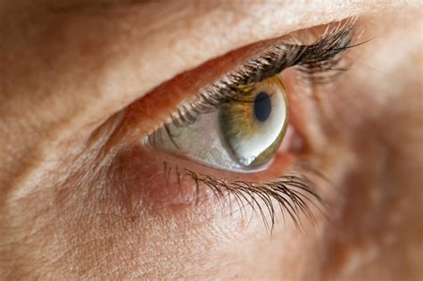 10 Tips Para Prevenir El Glaucoma