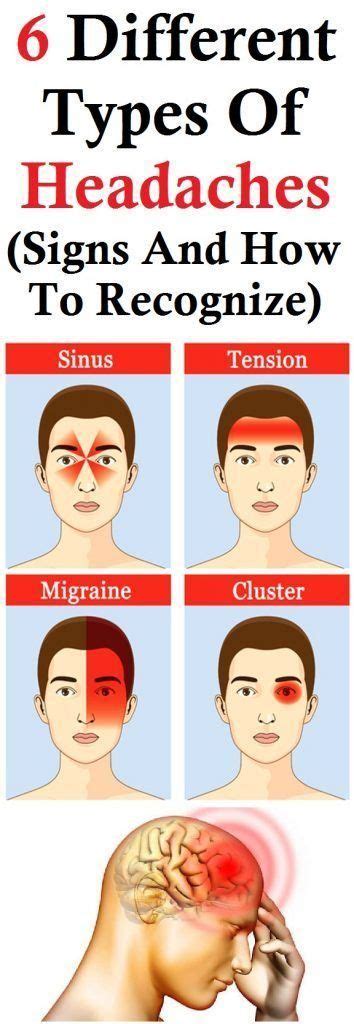 Types Of Headaches Chart Image