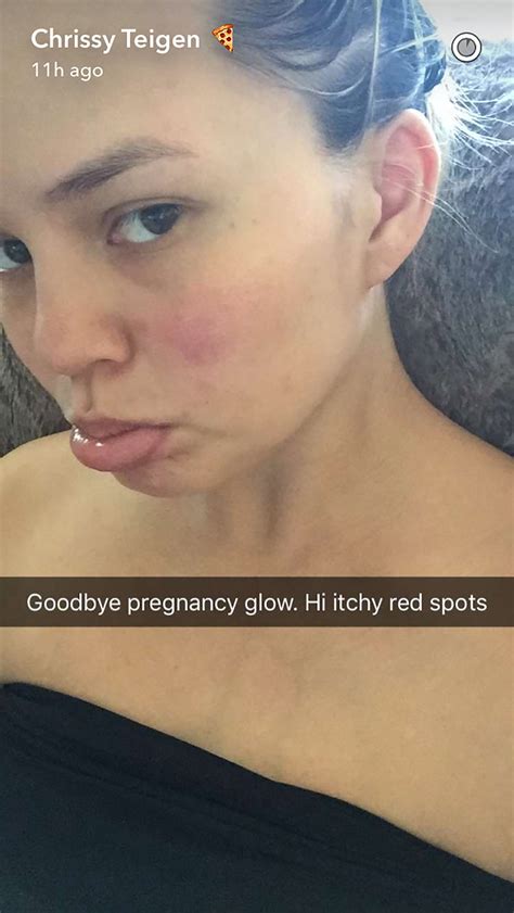 Chrissy Teigen Says Goodbye Pregnancy Glow In Funny Makeup Free