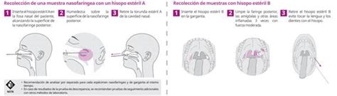 One of the tests in use for diagnosing active coronavirus. SARS-CoV-2 SD BIOSENSOR STANDARD Q COVID-19 Ag test - Pack 25