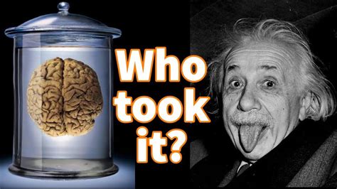 Where Is Albert Einsteins Brain What Happened To Albert Einsteins